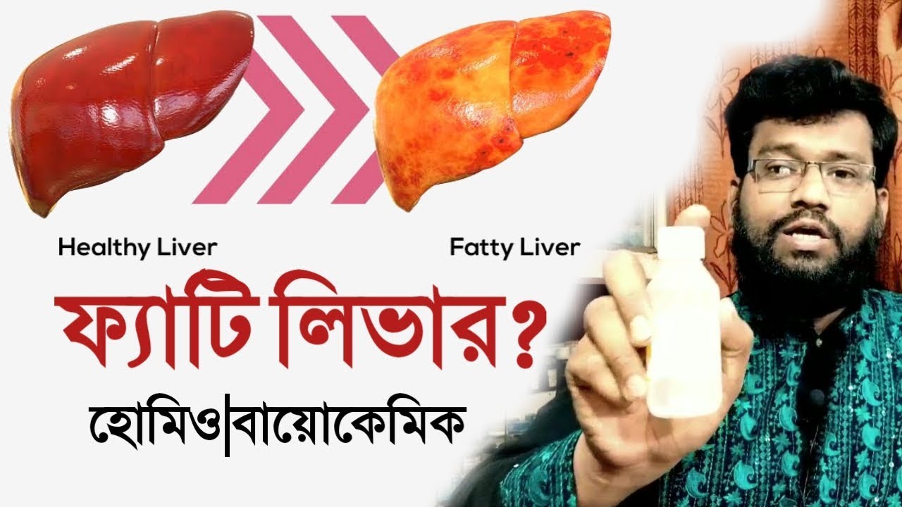 ফ্যাটি লিভারের | লিভারে চর্বি জমার হোমিও চিকিৎসা | fatty liver homeopathic treatment in bangla