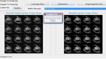 De watermarking With Tamper for bio images