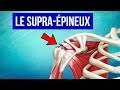 Tendinite du supra pineux  lpaule  explication et traitement