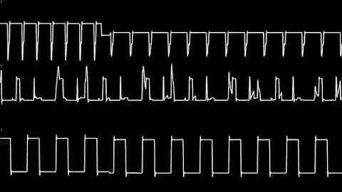 Blipblop Memories composed by !cube (Atari ST YM2149F) Oscilloscope