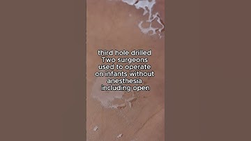 what is a disturbing fact you wish you could unlearn#redditreadings #redditstories #reddit #fyp