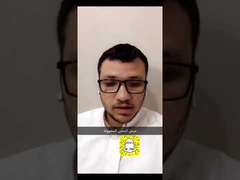 الاصعاد بالابل مرض الحمى المجهوله مع الدكتور مالك