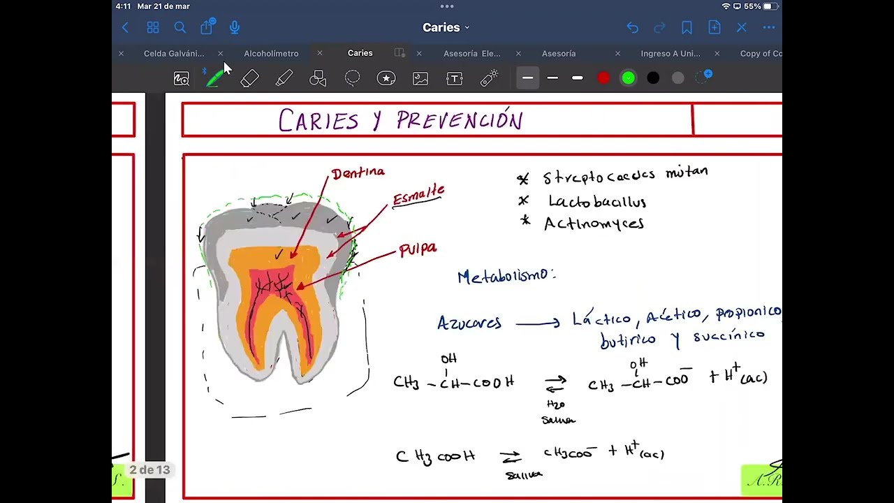 La caries dental. Parte 1: Desmineralización del esmalte