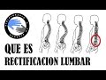 Rectificacion lumbar, que es y porque se produce