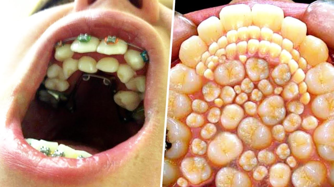 Rarest Body Features Only 1% Of People Have