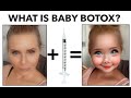 BABY BOTOX - All You Need To Know | skip2mylou