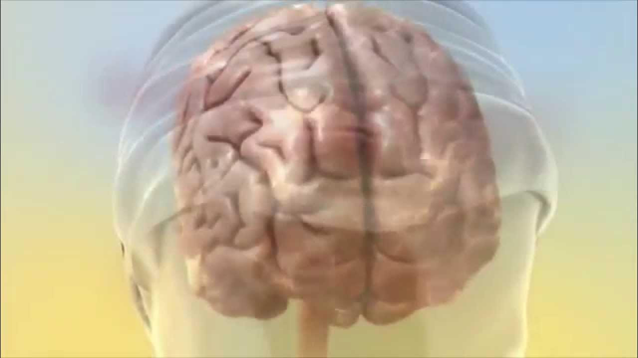 Acoustic CR Neuromodulation Tinnitus Treatment Acoustic CR Neuromodulation Tinnitus Treatment