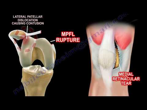 Basic Anatomy Of The Patella - Everything You Need To Know - Dr. Nabil Ebraheim