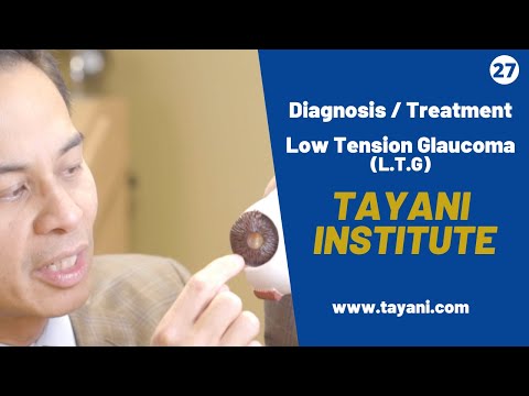 Low Tension Glaucoma / What To Expect | Tayani Institute