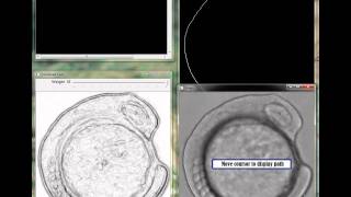 Intelligent Scissor for image segmentation