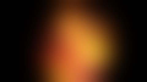 Fluorescent Cholangiography During Laparoscopic Cholecystectomy