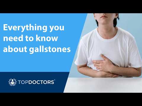 Everything you need to know about gallstones