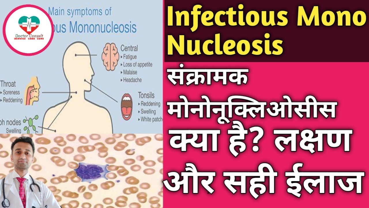⁣Infectious Mononucleosis! MONO! संक्रामक मोनो कि बीमारी क्या होती है? ईलाज क्या है ? पूरी जानकारी