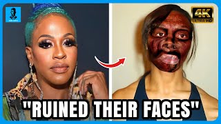 20 Black celebrities Who RUINED Their Careers With PLASTIC SURGERY | Black celebrities