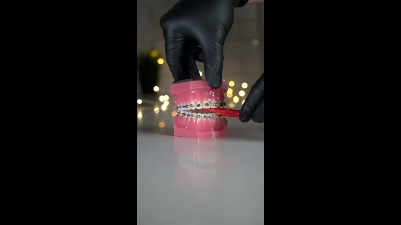 What Can You Eat With Braces Food Choices Spicy Flamin Hot Chips Edition ASMR W The Doc