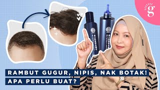 Cara Rawat Rambut Gugur Di Kalangan Lelaki | 50 Megumi