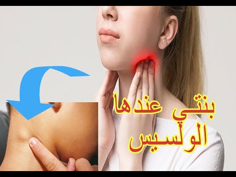 طفلي يعاني من الولسيس التهاب العقد اللمفاوية كيف أتعامل معه وطريقة علاجه والوقاية نصائح للأم و الأب