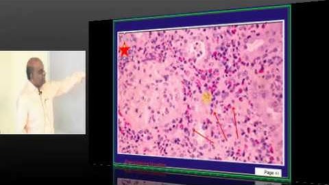 NEETPG Image Based MCQ