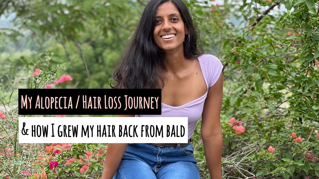 How I Cured My Hair Loss | My Journey - Alopecia Areata | All Natural | MeherOnFire | MOF