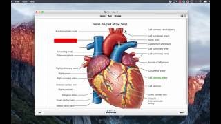 Anki for medical school: Studying anatomy using image occlusion