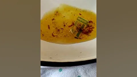 описторхи в желчи
