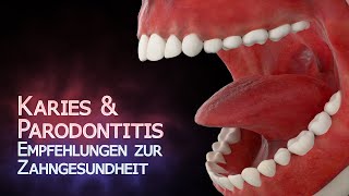 Karies & Parodontitis - Zahngesund ins hohe Alter (Animation)