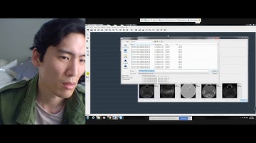 How to Export CBCT DICOM from Cliniview