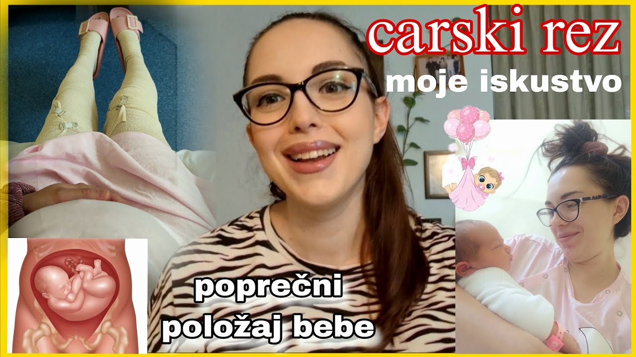 CARSKI REZ *detaljno* Moje iskustvo | Priprema pred operaciju i oporavak | Poprečni polozaj bebe