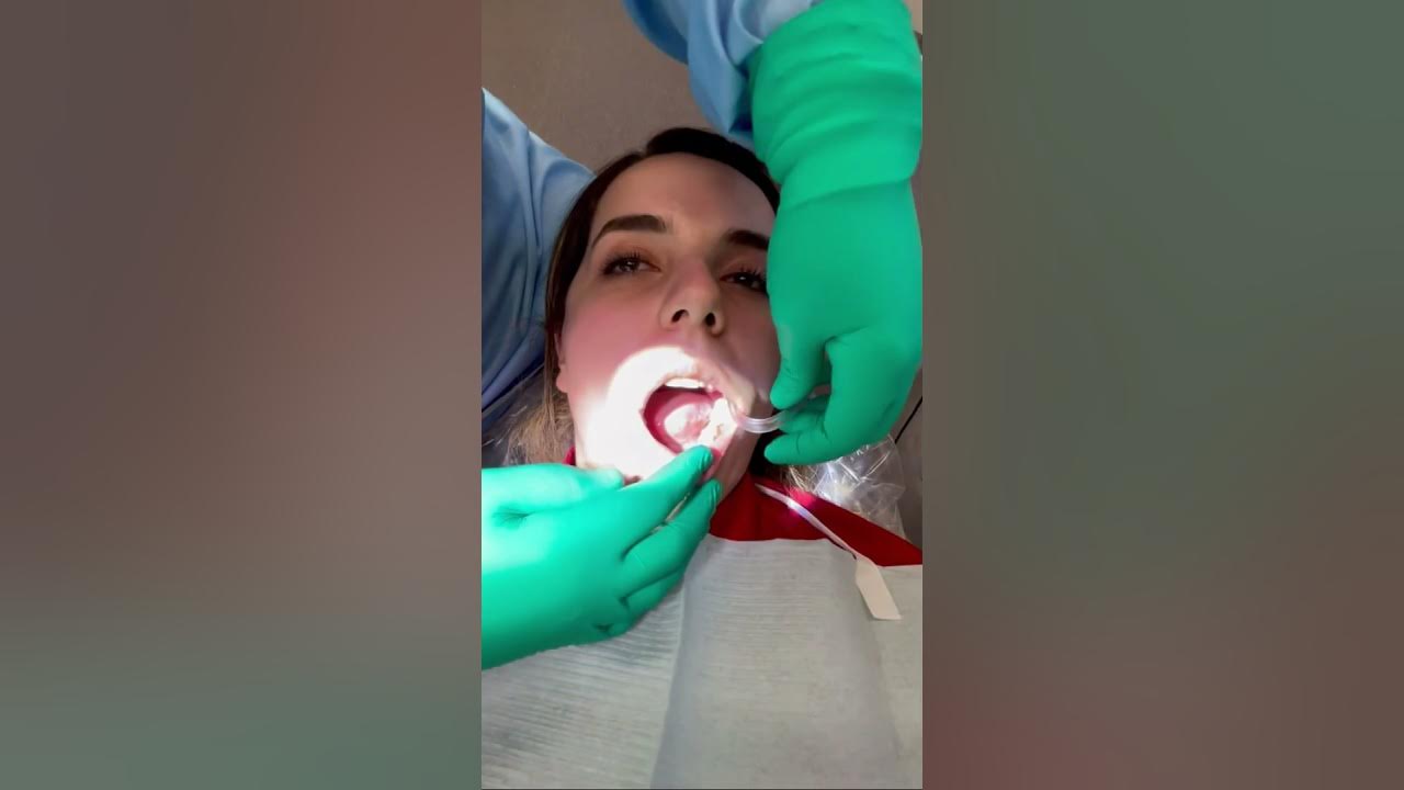 How to bend the saliva ejector for effective water control in dentistry