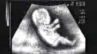 Baby_drawin_car(www.tamilwap.info).3gp