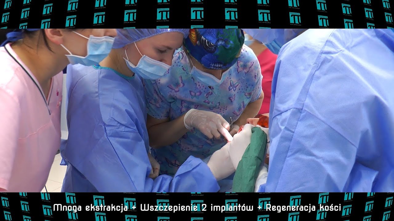 PRACTICULUM IMPLANTOLOGII SEZON VI SESJA 4   ZABIEG 3