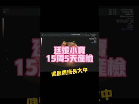 我們廷妮的小寶第三次露臉，健健康康長大中！確定性別了喔！（15週5天的超音波產檢記錄） #我們廷妮 #產檢 #超音波 #寶寶 #baby #胎兒 #胎動 #小寶 #驚喜 #廷妮小寶 #蕙生醫院