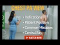 CHEST PA X-RAY POSITIONING MADE EASY | TIPS,MISTAKES AND TECHNIQUES|Radiology Tech