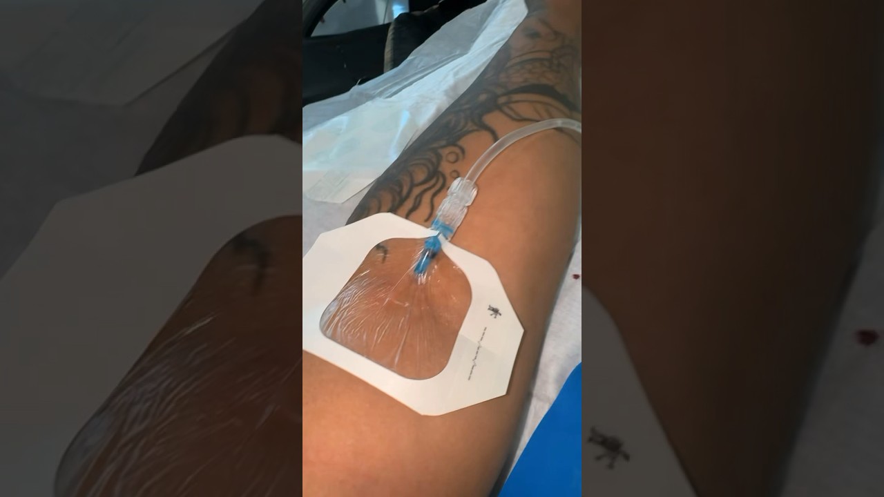 IV Therapy… Self Care Day 