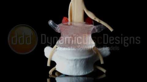 LxH Dynamic Disc Model by ddd