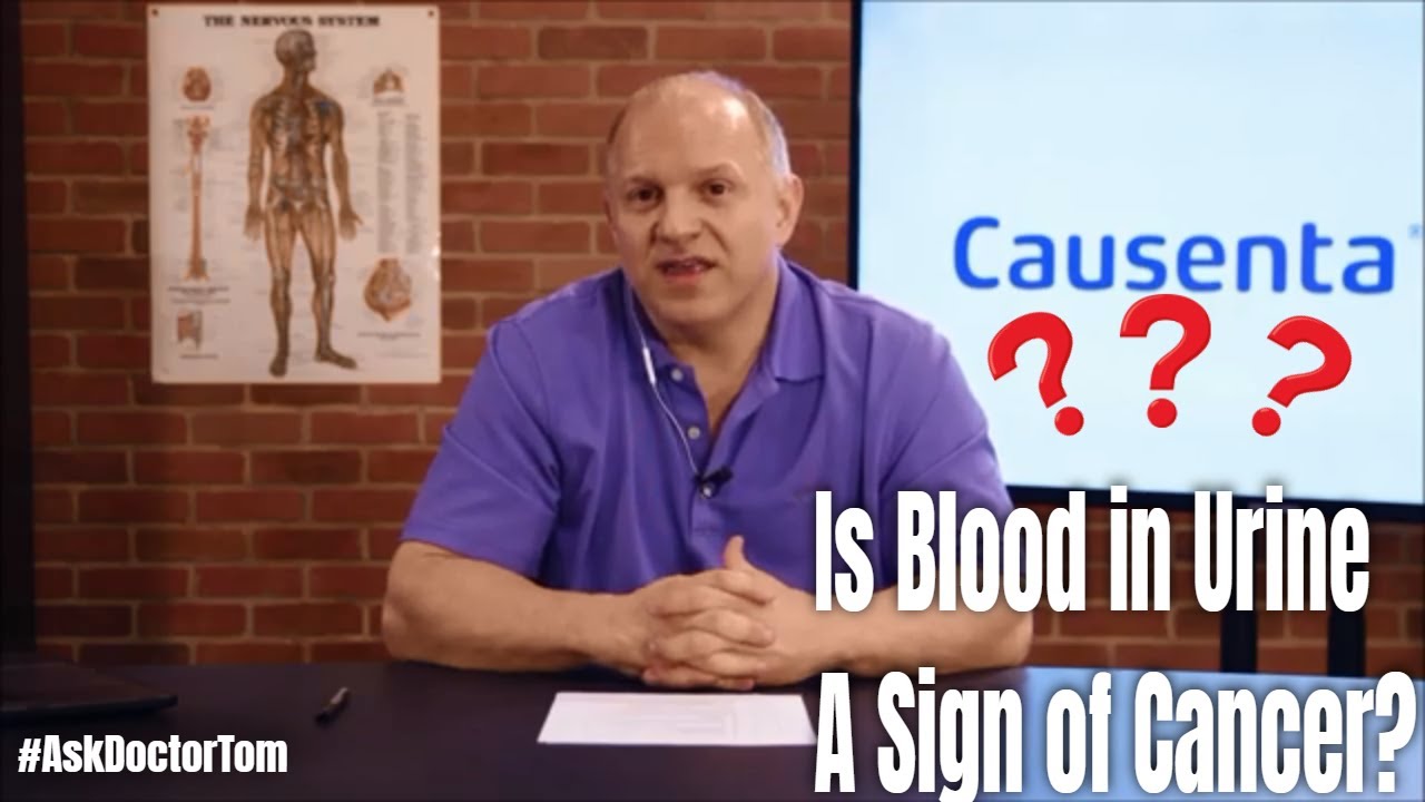 Thomas Incledon Does Blood in Urine lead to #BladderCancer?: Ask Doctor Tom with Doctor ...