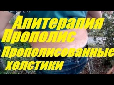 Лечение пчелиным ядом.Апитерапия. Яд пчёл-помогает! Лечим спину.