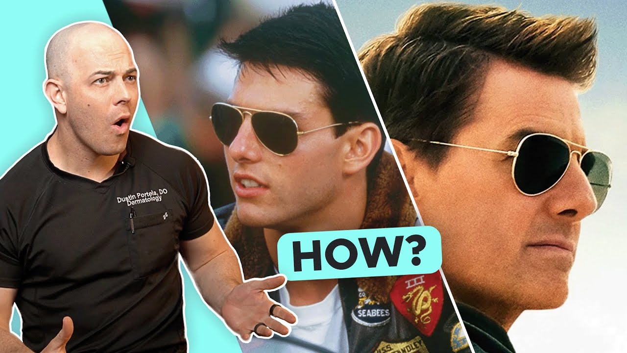 Tom Cruise Hair Loss tom-cruise-hair-loss
