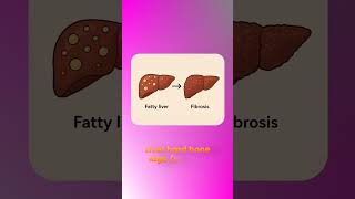 Fat vs. Liver Damage: What Your Report Actually Means