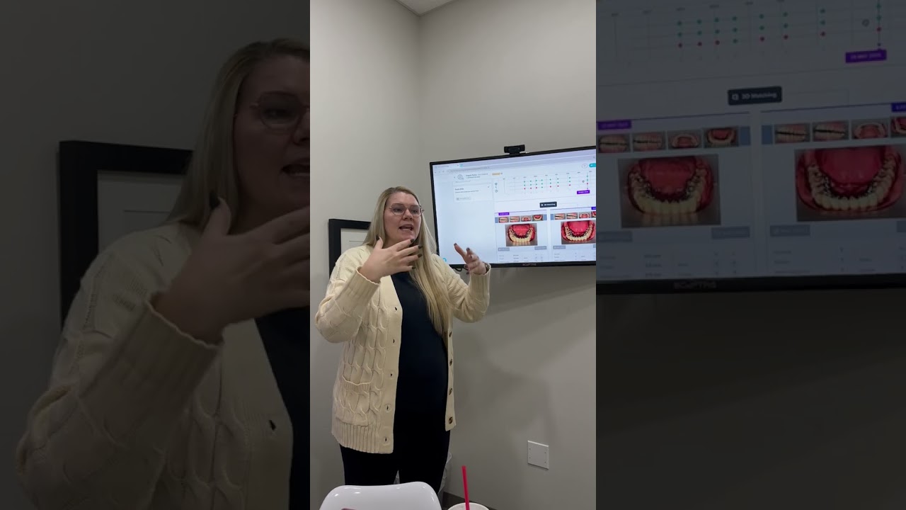 What To Expect With inBrace | Orthodontist for Teens and Adults | Houston, TX