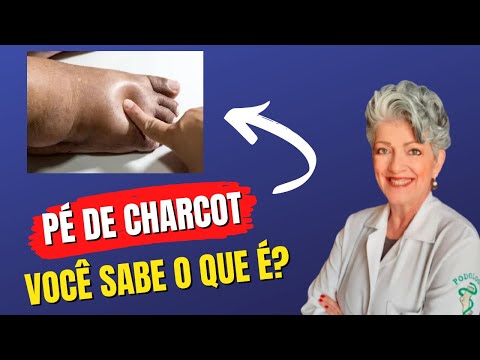 Vídeo: Quem fica com o pé de charcot?