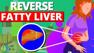 Top 10 Foods That Reverse Fatty Liver Disease
