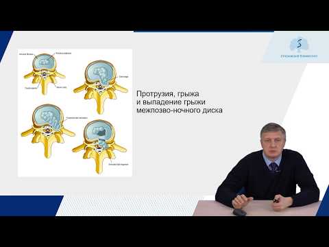 Лекция - боли в спине