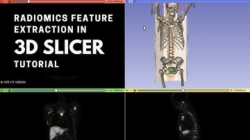 Extracting radiomics features in 3D Slicer tutorial