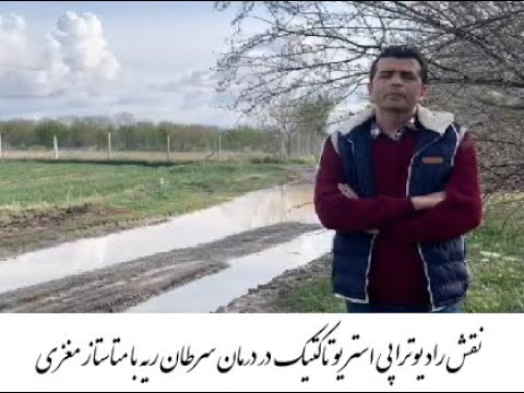 درمان سرطان ریه با متاستاز مغزی توسط بهترین متخصص رادیوتراپی در تهران