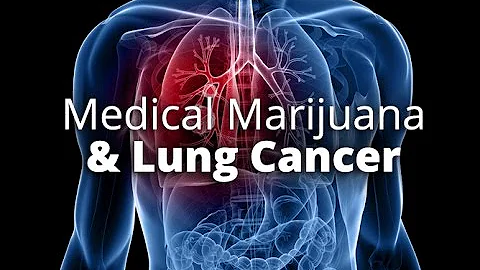 Michelle Aldrich Treats Her Lung Cancer with Canna...