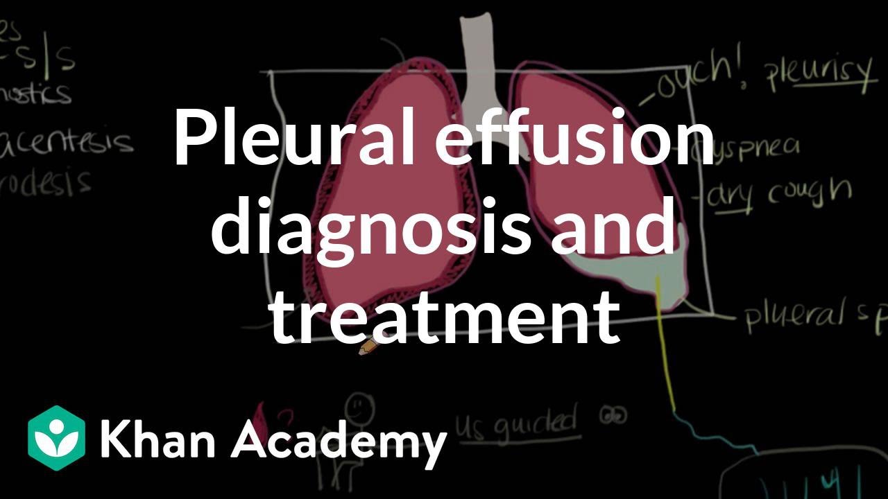 Pleural Effusion Diagnosis And Treatment Video Khan Academy