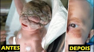 Bebê nasce com um enorme tumor no seu rosto até que...
