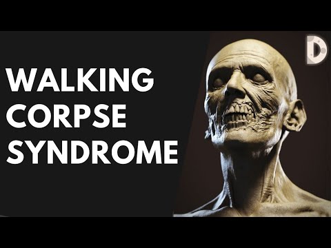 Video: Walking Corpse Syndroom - Alternatieve Mening