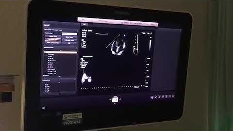 Bài giảng thực hành siêu âm tim | BV Bạch Mai 2022